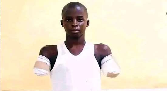 Man amputates his nephew's hand over phone theft