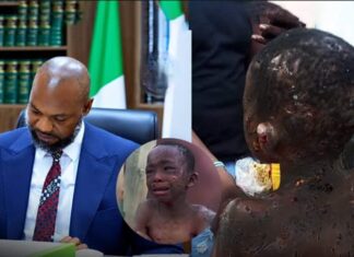 “They Want To Pursue A Plea Bargain” — Anambra AG Nweke, SAN, Prosecutes Couple Accused Of Burning 11-Year-Old House Help With Melted Plastic
